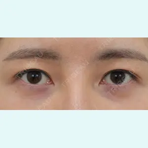 症例