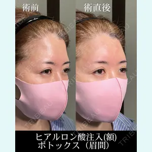 HAAB×DREAM BEAUTY CLINIC 大阪梅田院 柏木 太雅医師の症例