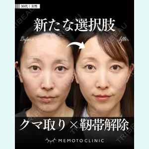 症例