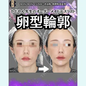 症例