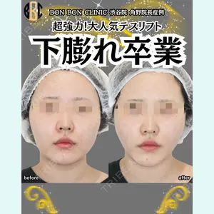 症例