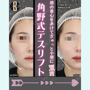 症例