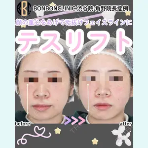 症例