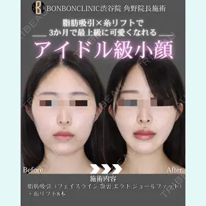 症例
