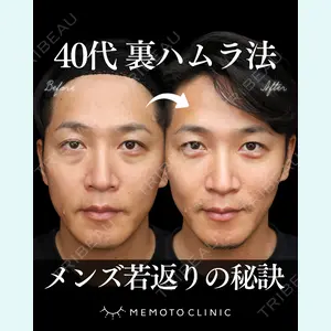 症例