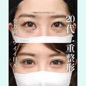 症例