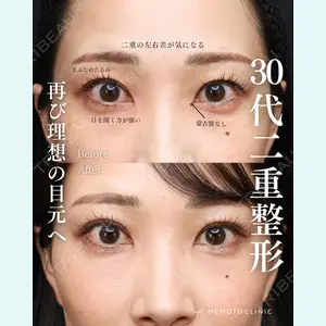 症例