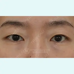症例