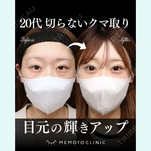 症例
