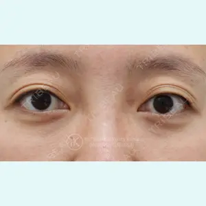 症例