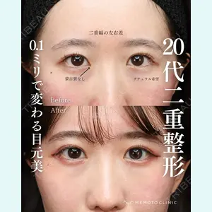 症例
