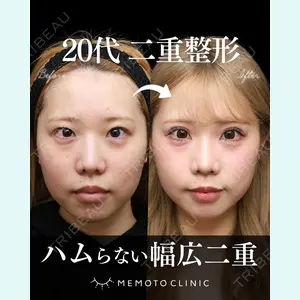 症例
