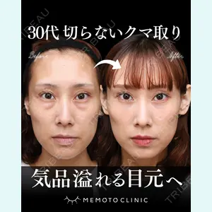症例