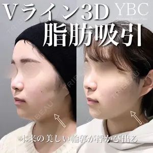 YBC横浜美容外科 大宮院 磯村 亮輔医師の症例