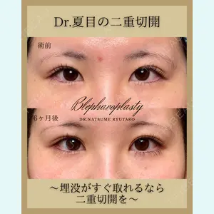 池袋麗歯科・美容皮膚科 夏目 隆太郎医師の症例