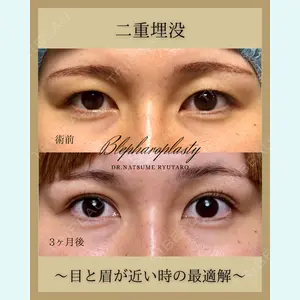 池袋麗歯科・美容皮膚科 夏目 隆太郎医師の症例