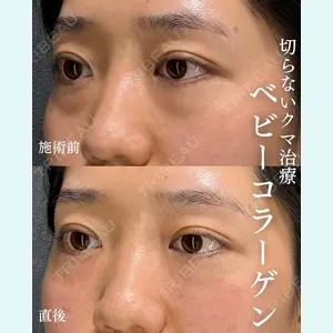 BIANCA表参道 大久保 由有医師の症例