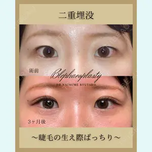 池袋麗歯科・美容皮膚科 夏目 隆太郎医師の症例