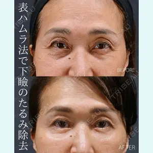 症例