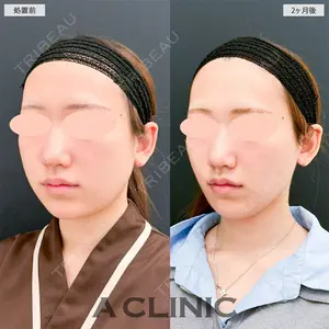 A CLINIC（エークリニック） 名古屋院 住田 篤紀医師の症例