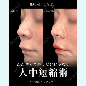 eクリニック 大阪院 八木 良太医師の症例