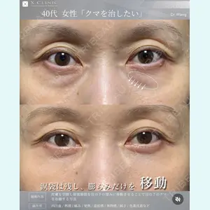 X CLINIC 銀座院 王　浚昊医師の症例