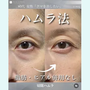 X CLINIC 銀座院 王　浚昊医師の症例