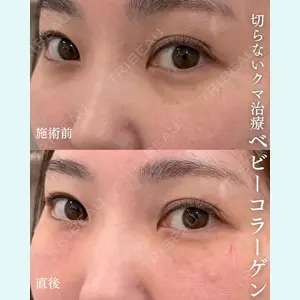 BIANCA表参道 大久保 由有医師の症例