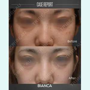 BIANCA銀座 葉山 愛弥医師の症例