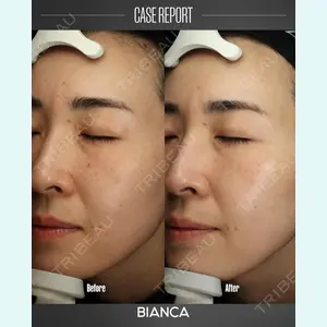 BIANCA銀座 葉山 愛弥医師の症例