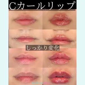 ルラ美容クリニック 札幌大通り院 能登 貴弘医師の症例