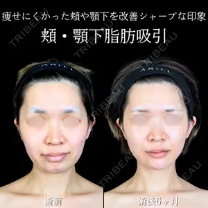 アリエル美容クリニック 横浜院 渡邉 光医師の症例