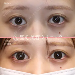 聖心美容クリニック 大阪院 大井 弘一医師の症例