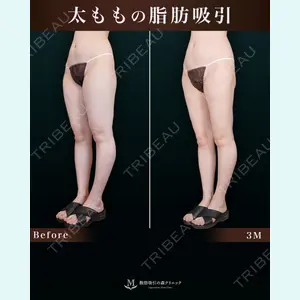 症例