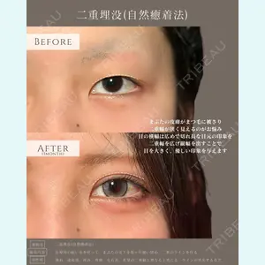 症例