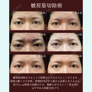 症例