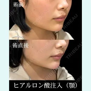 症例