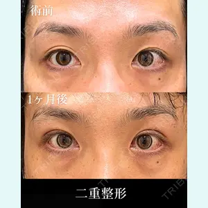症例