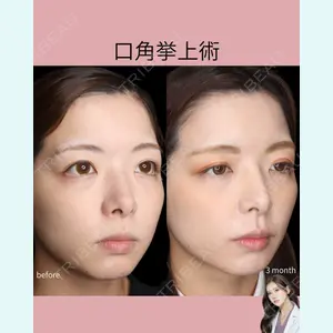症例
