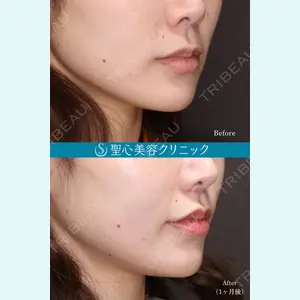 聖心美容クリニック 大阪院 寺町 英明医師の症例