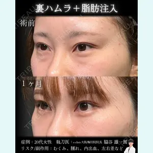 eクリニック 大阪梅田 西日本統括院 脇谷 雄一朗医師の症例