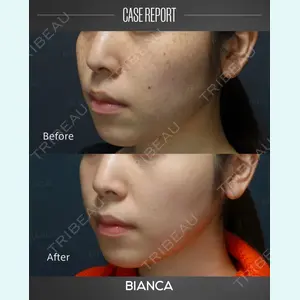 BIANCA銀座 葉山 愛弥医師の症例