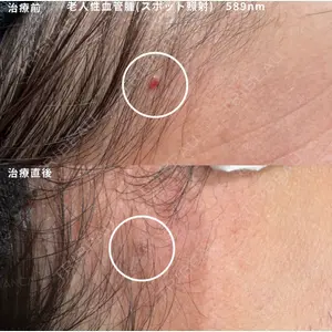 BIANCA表参道 岩間 美幸医師の症例