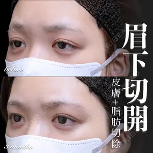 EMMO FACE CLINIC 大宮院 百瀬 直也医師の症例