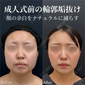 湘南美容クリニック 渋谷院 小草 智之医師の症例