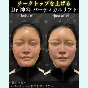 症例