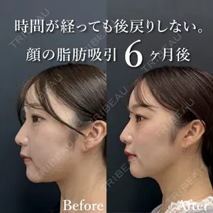 湘南美容クリニック 渋谷院 小草 智之医師の症例