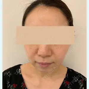 Rinato Beauty Clinic 関口 直樹医師の症例