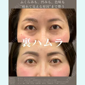 症例