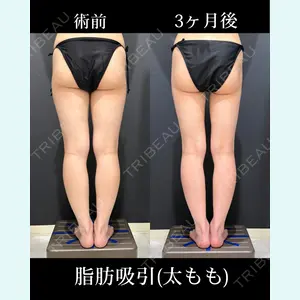 症例